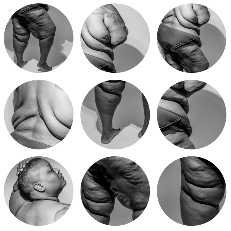 AN IMAGE GRID DISPLAYING DIFFERENT AREAS OF A FAT BLACK FEMME'S LIPEDEMA BODY UP CLOSE IN BLACK AND WHITE PORTRAITS